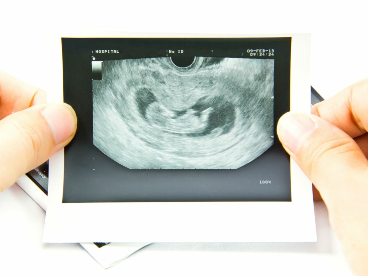 l-evolution-du-foetus-au-premier-trimestre-de-grossesse